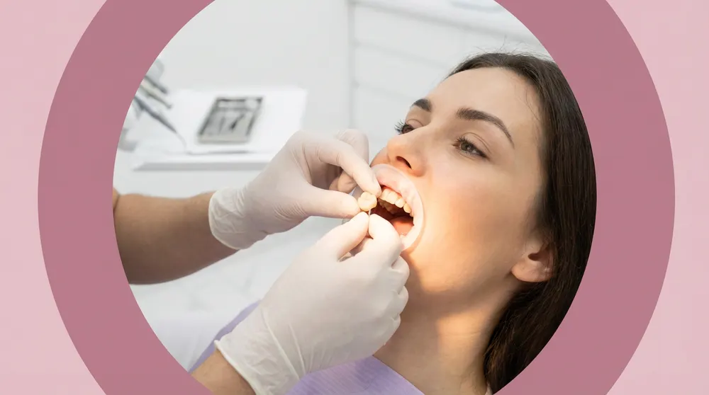 Dental Crown