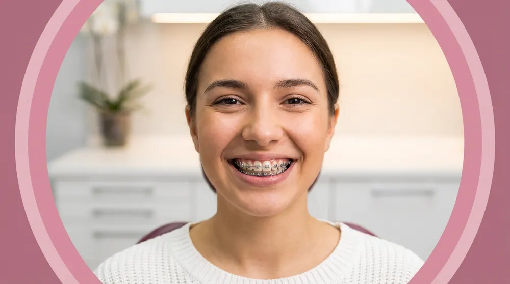 Tooth Braces