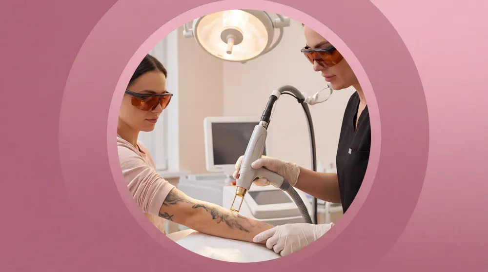 Tattoo Removal