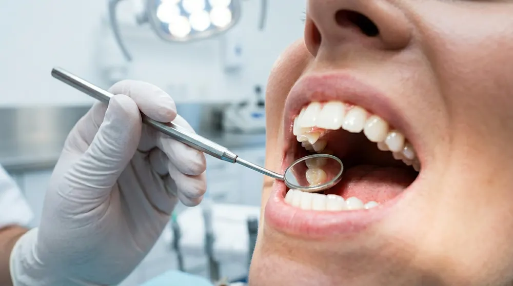 Dental treatments at LANA Clinic Karimnagar