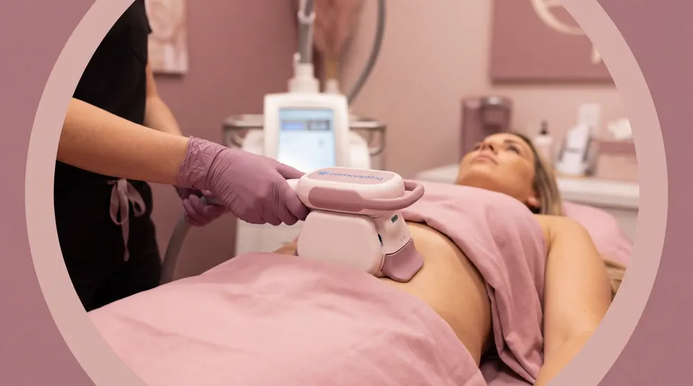 CoolSculpting Treatment
